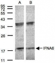 NBP1-31156 - IFNA6 / Interferon alpha-6