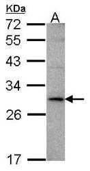 NBP1-31159 - TNFSF15