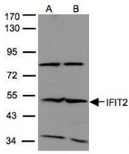 NBP1-31164 - IFI54 / IFIT2