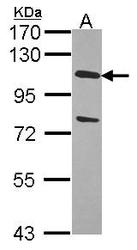 NBP1-31171 - USP28
