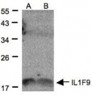 NBP1-31185 - IL1F9 / IL1H1