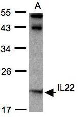 NBP1-31191 - Interleukin-22 / IL22