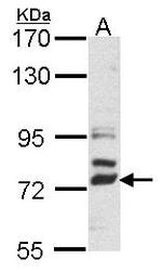 NBP1-31195 - Delta-like protein 4 / DLL4