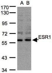 NBP1-31201 - Estrogen receptor alpha