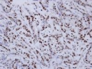 NBP1-31201 - Estrogen receptor alpha