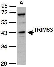 NBP1-31207 - TRIM63 / MURF1 / RNF28
