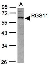 NBP1-31212 - RGS11