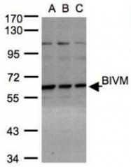 NBP1-31214 - BIVM