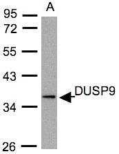 NBP1-31227 - DUSP9 / MKP4
