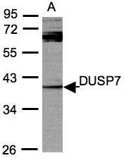 NBP1-31232 - DUSP7 / PYST2