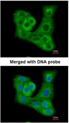 NBP1-31232 - DUSP7 / PYST2