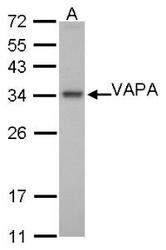 NBP1-31237 - VAMP-associated protein A (VAPA)