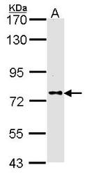 NBP1-31256 - DPP8 / DPRP1