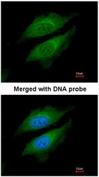 NBP1-31256 - DPP8 / DPRP1