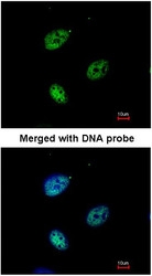 NBP1-31260 - KPNA4 / Importin alpha-4