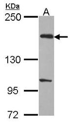 NBP1-31268 - Limbin