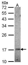 NBP1-31293 - UBE2B / RAD6B