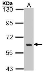NBP1-31297 - YES1