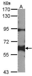 NBP1-31297 - YES1