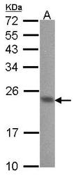 NBP1-31298 - ABHD14B