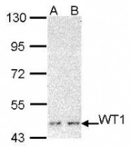 NBP1-31314 - WT1 / Wilms tumor protein