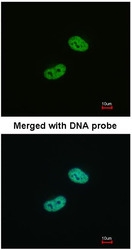 NBP1-31314 - WT1 / Wilms tumor protein