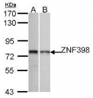 NBP1-31317 - ZNF398