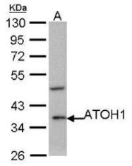 NBP1-31318 - ATOH1