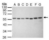NBP1-31339 - XRCC4