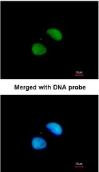 NBP1-31339 - XRCC4