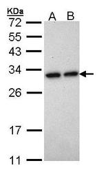 NBP1-31341 - Heme oxygenase 1 / HMOX1