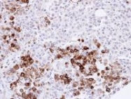 NBP1-31341 - Heme oxygenase 1 / HMOX1