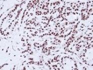 NBP1-31354 - PRPF19 / NMP200