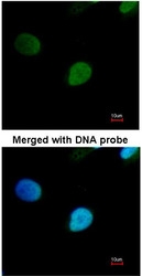 NBP1-31354 - PRPF19 / NMP200