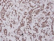 NBP1-31356 - BAT1 / UAP56