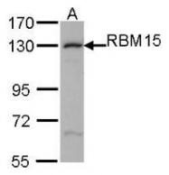 NBP1-31364 - RBM15