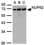 NBP1-31381 - NUP62