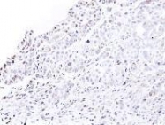 NBP1-31381 - NUP62