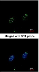 NBP1-31382 - RPA1