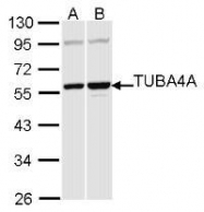 NBP1-31392 - alpha Tubulin / TUBA4A / TUBA1