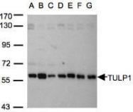 NBP1-31401 - TULP1