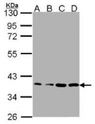 NBP1-31413 - RPL5