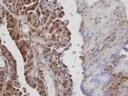 NBP1-31426 - VAV1