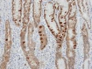 NBP1-31430 - Isocitrate dehydrogenase / IDH2