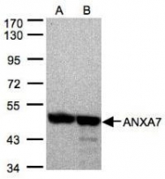 NBP1-31442 - Annexin A7 / ANXA7
