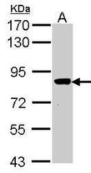 NBP1-31455 - VPS16