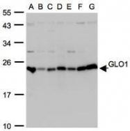NBP1-31466 - Glyoxalase I / GLO1