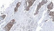NBP1-31466 - Glyoxalase I / GLO1