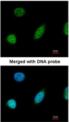 NBP1-31466 - Glyoxalase I / GLO1