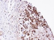 NBP1-31470 - Triosephosphate isomerase (TPI1)